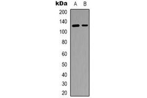 Western blot analysis of SFRS15 expression in RT4 (A), Colo205 (B) whole cell lysates. (SCAF4 antibody)