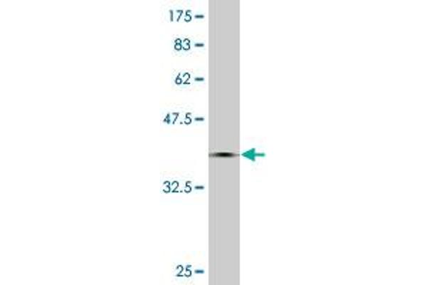 CMTM5 antibody  (AA 1-156)