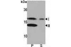 Western blot analysis of LC3 antibody and rat brain lysate: Both lipidated (arrow, II) and non-lipidated (arrow, I) were detected in membrane fraction (P) but only non-lipidated LC3 was detected in soluble fraction (S). (MAP1LC3A antibody  (AA 1-30))