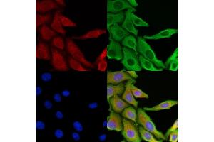 ABIN6266031 and ABIN6269398 staining HepG2 cells by IF/ICC. (WNK1 antibody  (N-Term))