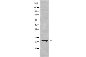 Western blot analysis of TMEM37 using HUVEC whole cell lysates