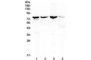 Western blot testing of 1) rat kidney, 2) mouse kidney, 3) mouse lung and 4) human MCF7 lysate with Calpain 2 antibody at 0.
