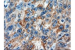 Immunohistochemical staining of paraffin-embedded colon using anti-KRT18 (ABIN2452646) mouse monoclonal antibody.