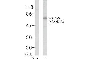 Image no. 1 for anti-Checkpoint Kinase 2 (CHEK2) (pSer516) antibody (ABIN196867) (CHEK2 antibody  (pSer516))