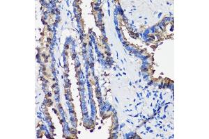 Immunohistochemistry of paraffin-embedded rat lung using SCGB1 antibody (6997) at dilution of 1:100 (40x lens). (SCGB1A1 antibody  (AA 22-91))