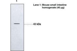Image no. 1 for anti-Leukotriene B4 Receptor 2 (LTB4R2) antibody (ABIN2451486) (LTB4R2 antibody)