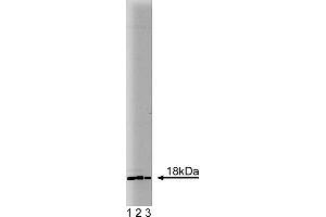 Western Blotting (WB) image for anti-Ubiquitin-Conjugating Enzyme E2I (UBE2I) (AA 26-156) antibody (ABIN968155) (UBE2I antibody  (AA 26-156))