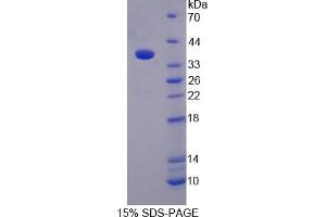 SDS-PAGE analysis of Monoamine Oxidase B Protein.