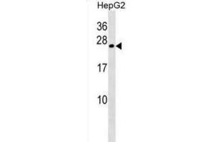 Western Blotting (WB) image for anti-Crystallin, gamma B (CRYGB) antibody (ABIN2998589) (CRYGB antibody)