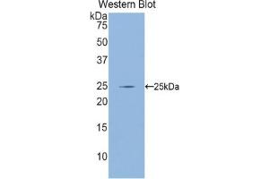 Detection of Recombinant GCLC, Mouse using Polyclonal Antibody to Glutamate Cysteine Ligase, Catalytic (GCLC) (GCLC antibody  (AA 435-636))