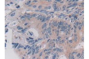 Immunohistochemistry (IHC) image for anti-Legumain (LGMN) (AA 18-433) antibody (ABIN7435007)