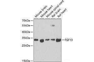 Western blot analysis of extracts of various cell lines using FGF13 Polyclonal Antibody at dilution of 1:1000. (FGF13 antibody)