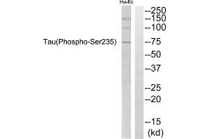 Western blot analysis of extracts from HuvEc cells, using Tau (Phospho-Ser235) Antibody. (tau antibody  (pSer235))