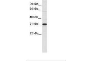 Image no. 1 for anti-Nuclear Receptor Interacting Protein 2 (NRIP2) (AA 27-76) antibody (ABIN6736079) (NRIP2 antibody  (AA 27-76))
