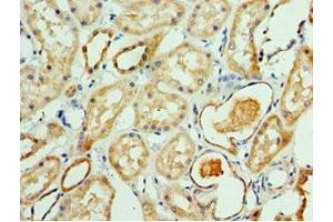 Immunohistochemistry of paraffin-embedded human kidney tissue using ABIN7145043 at dilution of 1:100 (ATAD3B antibody  (AA 1-240))