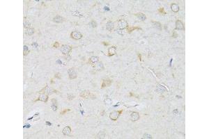 Immunohistochemistry of paraffin-embedded Rat brain using SLC2A13 Polyclonal Antibody at dilution of 1:100 (40x lens). (SLC2A13 antibody)