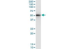 Immunoprecipitation of STAM transfected lysate using anti-STAM monoclonal antibody and Protein A Magnetic Bead , and immunoblotted with STAM monoclonal antibody.