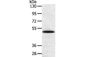 Western blot analysis of Human placenta tissue, using SMOC2 Polyclonal Antibody at dilution of 1:250 (SMOC2 antibody)