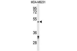 Western blot analysis of CBX2 Antibody (N-term) in MDA-MB231 cell line lysates (35µg/lane).