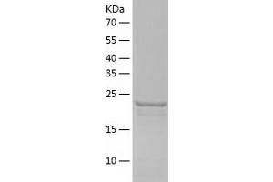 Western Blotting (WB) image for 14-3-3 eta (YWHAH) (AA 1-246) protein (His tag) (ABIN7121597)