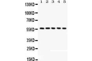 Anti- CREB3L1 Picoband antibody, Western blotting All lanes: Anti CREB3L1  at 0.