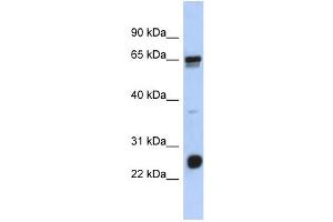 WB Suggested Anti-C1orf103 Antibody Titration: 0. (C1orf103 antibody  (N-Term))