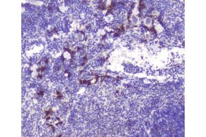 IHC analysis of RASAL1 using anti-RASAL1 antibody (ABIN6719367). (RASAL1 antibody  (AA 721-798))
