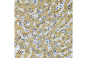Immunohistochemistry of paraffin-embedded human liver injury using SDC4 Antibody (ABIN1874710) at dilution of 1:100 (40x lens). (SDC4 antibody)
