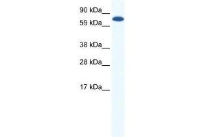 CBFA2T2H antibody used at 0. (CBFA2T2 antibody  (Middle Region))