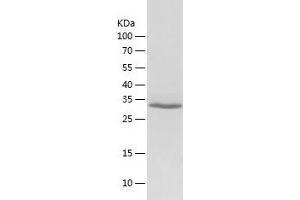 Western Blotting (WB) image for AMMECR1-Like (AMMECR1L) (AA 1-310) protein (His tag) (ABIN7121816) (AMMECR1-Like Protein (AMMECR1L) (AA 1-310) (His tag))