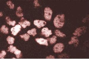 Immunofluorescent staining of A431 cells. (ARNT antibody  (AA 461-574))