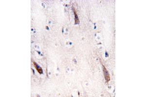 Formalin-fixed and paraffin-embedded human brain tissue reacted with ULK2 antibody (N-term) (ABIN392692 and ABIN2842178) , which was peroxidase-conjugated to the secondary antibody, followed by DAB staining. (ULK2 antibody  (N-Term))