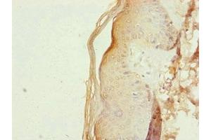Immunohistochemistry of paraffin-embedded human skin tissue using ABIN7151127 at dilution of 1:100 (RNF114 antibody  (AA 1-228))