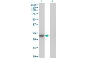 Western Blotting (WB) image for anti-NME/NM23 Nucleoside Diphosphate Kinase 6 (NME6) (AA 1-195) antibody (ABIN599508) (NME6 antibody  (AA 1-195))