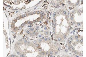 Immunohistochemistry (IHC) image for anti-Nuclear Factor of kappa Light Polypeptide Gene Enhancer in B-Cells Inhibitor, alpha (NFKBIA) (pTyr305) antibody (ABIN6255877)