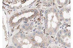 ABIN6267450 at 1/100 staining human kidney tissue sections by IHC-P.