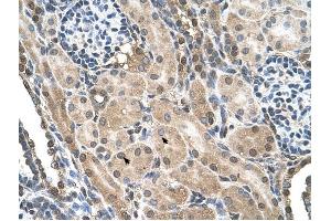 FLJ22167 antibody was used for immunohistochemistry at a concentration of 4-8 ug/ml to stain Epithelial cells of renal tubule (arrows) in Human Kidney. (FLJ22167 (N-Term) antibody)