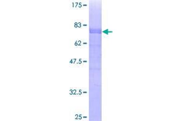 ARFGAP1 Protein (AA 1-414) (GST tag)