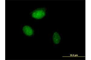 Immunofluorescence of purified MaxPab antibody to ZNF215 on HeLa cell. (ZNF215 antibody  (AA 1-304))