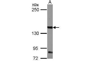 WB Image Sample (30 ug of whole cell lysate) A: K562 5% SDS PAGE antibody diluted at 1:1000 (CD131 antibody  (Center))