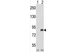 Western blot analysis of ADRBK2 (arrow) using rabbit polyclonal ADRBK2 Antibody (ADRBK2 antibody  (N-Term))