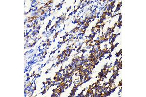 Immunohistochemistry of paraffin-embedded human appendix using NF-κB2 antibody (ABIN7268983) at dilution of 1:100 (40x lens).