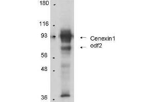 Anti-Cenexin-1 in Western Blot using  Immunochemical's Protein A Purified Anti-Cenexin-1 antibody shows detection of Cenexin-1 in total cell lysates from mouse F9 embryonic carcinoma cells. (ODF2 antibody)