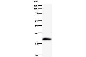 Western Blotting (WB) image for anti-Polymerase (RNA) I Polypeptide D, 16kDa (POLR1D) antibody (ABIN931069) (POLR1D antibody)