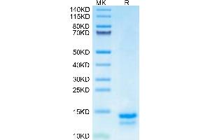 Mouse FAM19A5 on Tris-Bis PAGE under reduced condition. (FAM19A5 Protein (AA 44-132) (His tag))