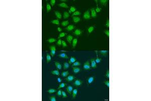 Immunofluorescence analysis of U2OS cells using EYA3 antibody (ABIN6292902) at dilution of 1:100. (EYA3 antibody)