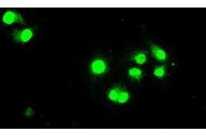 Image no. 6 for anti-Signal Transducer and Activator of Transcription 1, 91kDa (STAT1) antibody (ABIN1501168) (STAT1 antibody)