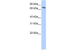 WB Suggested Anti-SLC11A2 Antibody Titration:  0.