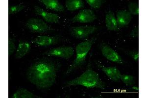 Immunofluorescence of monoclonal antibody to USO1 on HeLa cell. (USO1 antibody  (AA 1-961))