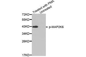 Western blot analysis of extracts from HL60 cells, using phospho-MAP2K6-S207 antibody (ABIN2988139). (MAP2K6 antibody  (pSer207))